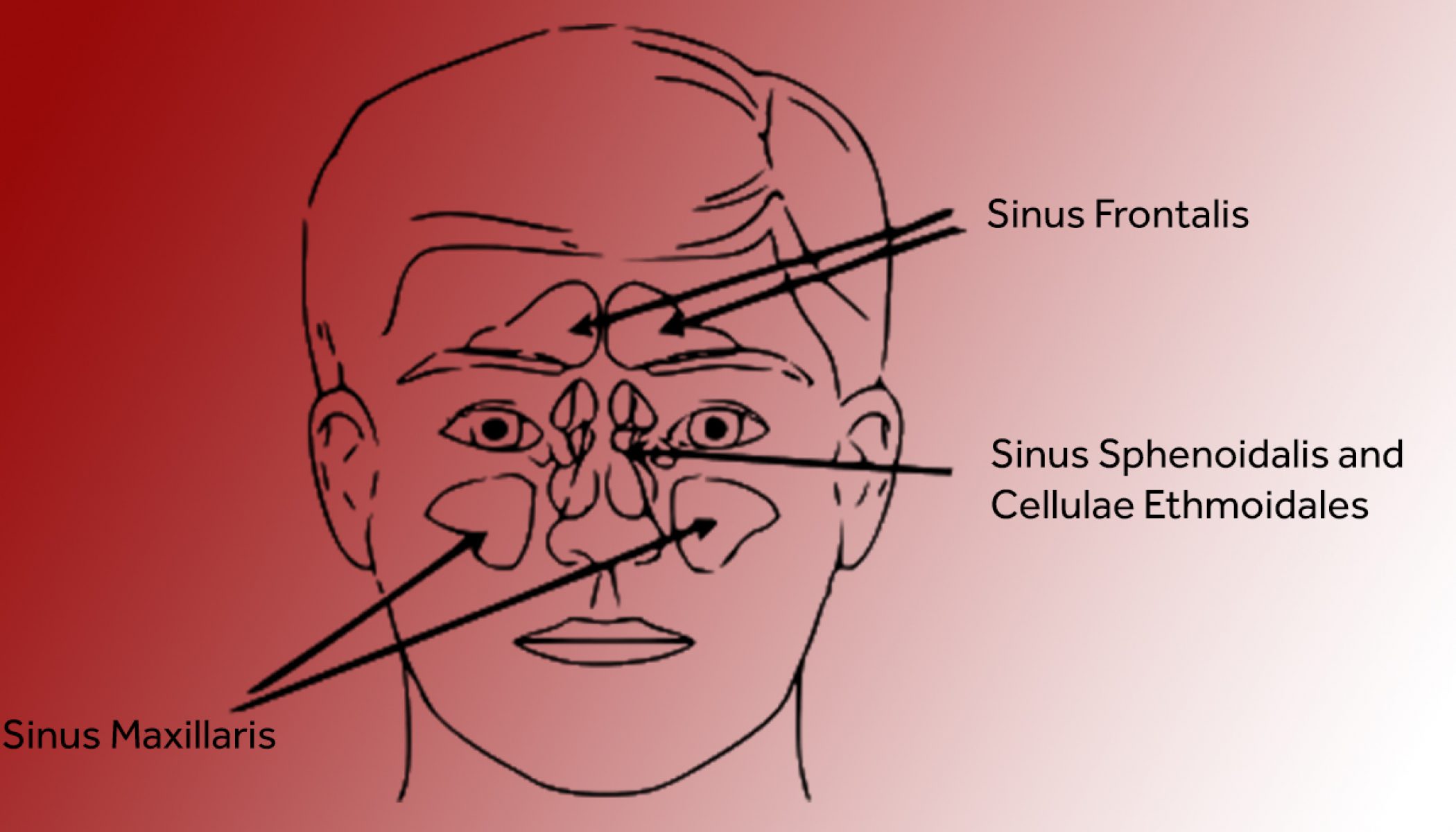 sinus-headache-what-is-it-atyutka-health