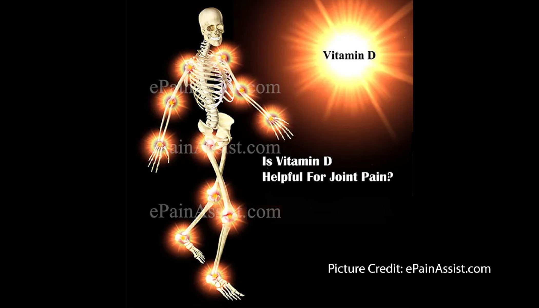 Vitamin D and Joint Pain Atyutka Health