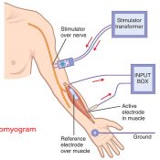 What is Electromyogram